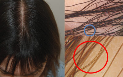 PERCHÈ NON DEVI USARE LA PIASTRA SUI CAPELLI UMIDI