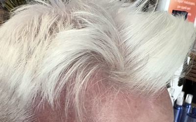 Cute Arrossata Dopo la Decolorazione: Sensibilizzazione o Danno Chimico?